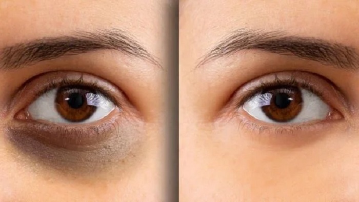 AVS PLASTIC SURGERY AND SKIN CLINIC Pudukkottai